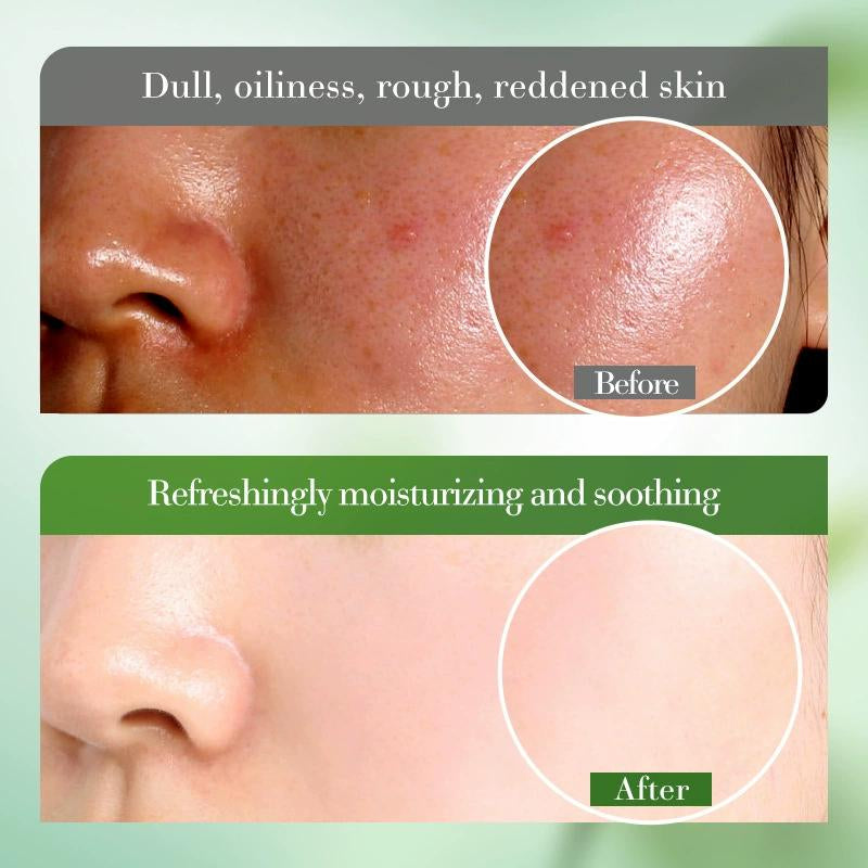 Hydrated Ever Toner with 99% Aloe Vera Extract & Hyaluronic Acid for Moisturizing, Locks in Water, Soothing and Repairs Sun Damage, 4.58 Oz