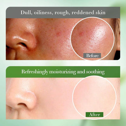 Hydrated Ever Toner with 99% Aloe Vera Extract & Hyaluronic Acid for Moisturizing, Locks in Water, Soothing and Repairs Sun Damage, 4.58 Oz